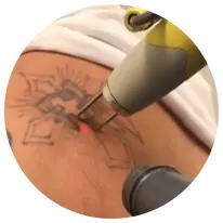Tattoo needle on customer