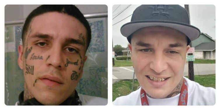 Face Tattoo Removal